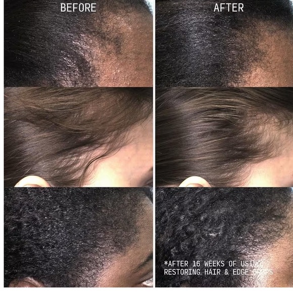 CéCRED Silver Hair & Edge Restoring Drops - Picture 3 of 5